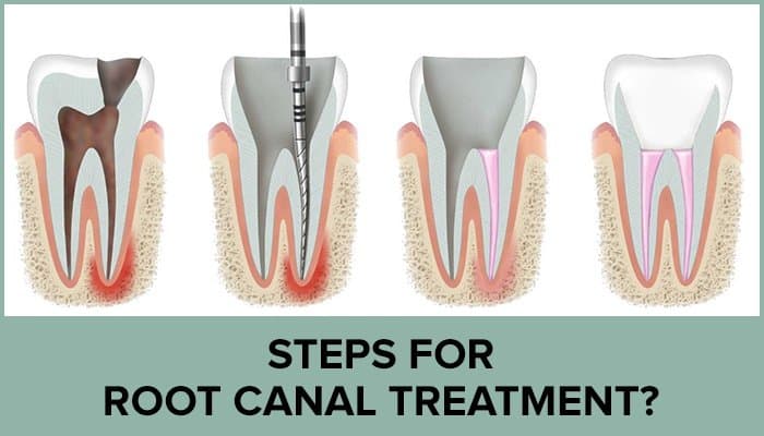 Clinical dental assessment before restorative treatment