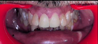 Before dental treatment at Dentara