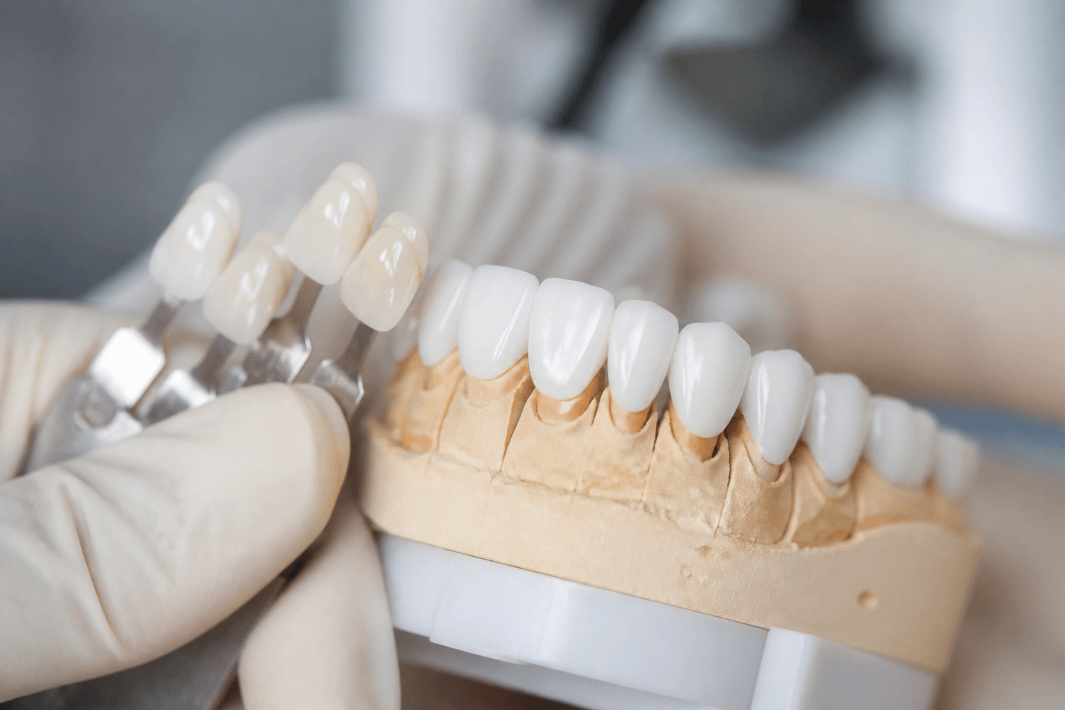 Dental crowns and veneers at Dentara